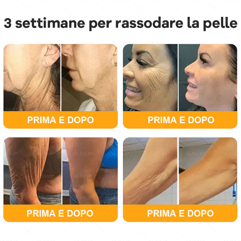 𝙑𝙇𝙎𝙑𝙇𝙎® VELENO D"API Crema rigenerante per la pelle – 🌸 Anti-age, Idratazione, Riparazione della pelle, Uniformità dell’incarnato, Trattamento per acne e macchie scure, Rimozione di verruche e nei, 𝐒𝐨𝐥𝐥𝐢𝐞𝐯𝐨 𝐝𝐚𝐥𝐥𝐚 𝐩𝐬𝐨𝐫𝐢𝐚𝐬𝐢