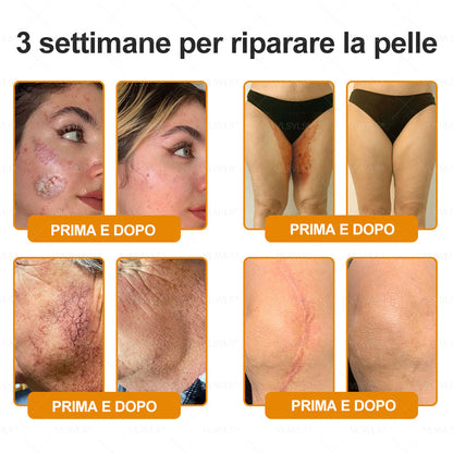 𝙑𝙇𝙎𝙑𝙇𝙎® VELENO D"API Crema rigenerante per la pelle – 🌸 Anti-age, Idratazione, Riparazione della pelle, Uniformità dell’incarnato, Trattamento per acne e macchie scure, Rimozione di verruche e nei, 𝐒𝐨𝐥𝐥𝐢𝐞𝐯𝐨 𝐝𝐚𝐥𝐥𝐚 𝐩𝐬𝐨𝐫𝐢𝐚𝐬𝐢