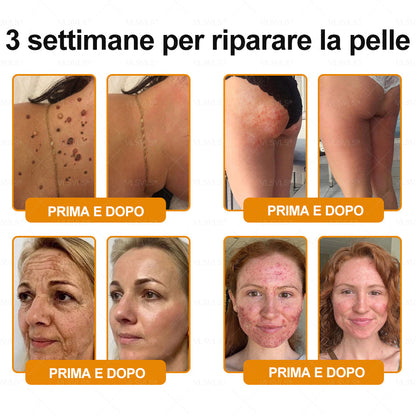 𝙑𝙇𝙎𝙑𝙇𝙎® VELENO D"API Crema rigenerante per la pelle – 🌸 Anti-age, Idratazione, Riparazione della pelle, Uniformità dell’incarnato, Trattamento per acne e macchie scure, Rimozione di verruche e nei, 𝐒𝐨𝐥𝐥𝐢𝐞𝐯𝐨 𝐝𝐚𝐥𝐥𝐚 𝐩𝐬𝐨𝐫𝐢𝐚𝐬𝐢