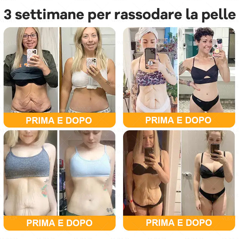 𝙑𝙇𝙎𝙑𝙇𝙎® VELENO D"API Crema rigenerante per la pelle – 🌸 Anti-age, Idratazione, Riparazione della pelle, Uniformità dell’incarnato, Trattamento per acne e macchie scure, Rimozione di verruche e nei, 𝐒𝐨𝐥𝐥𝐢𝐞𝐯𝐨 𝐝𝐚𝐥𝐥𝐚 𝐩𝐬𝐨𝐫𝐢𝐚𝐬𝐢