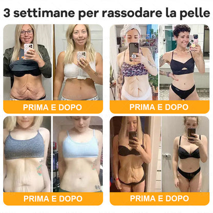 𝙑𝙇𝙎𝙑𝙇𝙎® VELENO D"API Crema rigenerante per la pelle – 🌸 Anti-age, Idratazione, Riparazione della pelle, Uniformità dell’incarnato, Trattamento per acne e macchie scure, Rimozione di verruche e nei, 𝐒𝐨𝐥𝐥𝐢𝐞𝐯𝐨 𝐝𝐚𝐥𝐥𝐚 𝐩𝐬𝐨𝐫𝐢𝐚𝐬𝐢